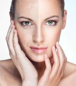 Detox für die Haut: die 3 besten Tipps gegen Hautunreinheiten